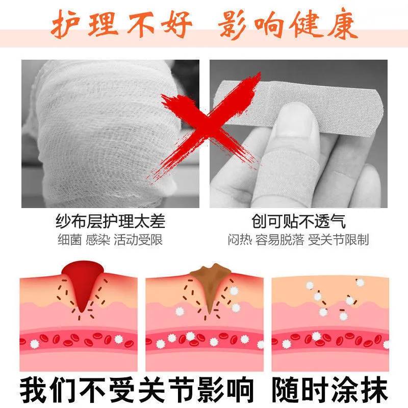 生肌散刀伤药金创止血外用伤口愈合专用金疮药人用云南药粉消炎