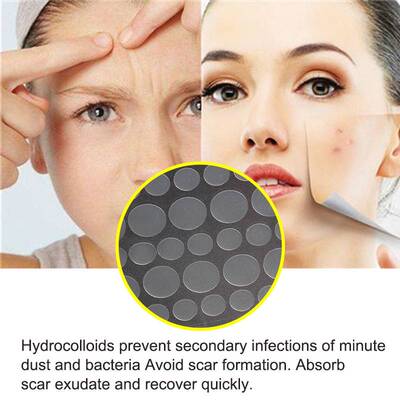 极速108pcs Warts Remover Patch Skin Tag Remover Wart Treatme