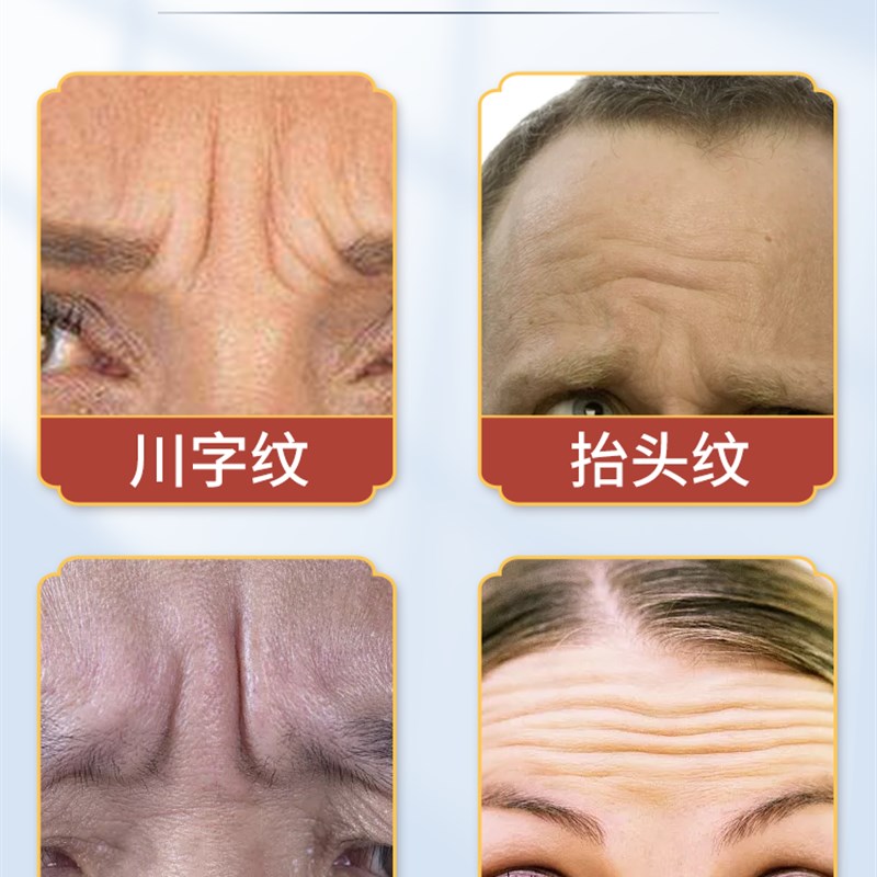 川字纹去除神器抬头纹额头纹眉间皱纹法令纹男女士消除提拉紧致贴