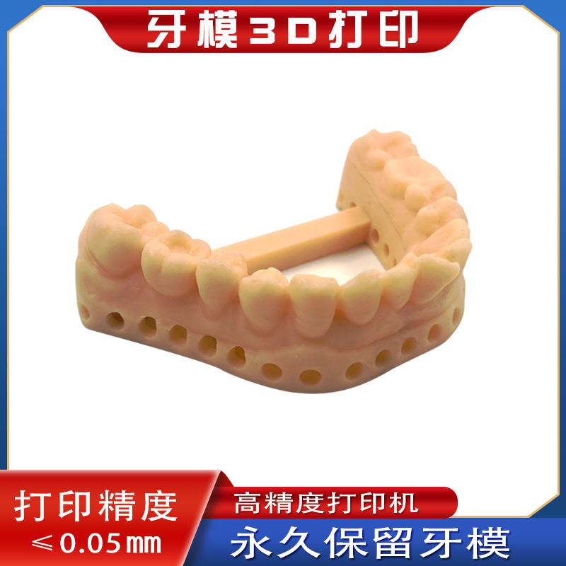 牙齿透明牙套保持器定制 3D牙模数据3D打印牙齿模型 石膏模型保留