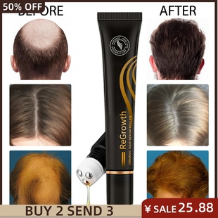 Hair Loss Treatment Fast Regrowth Essential Anti-loss Serum