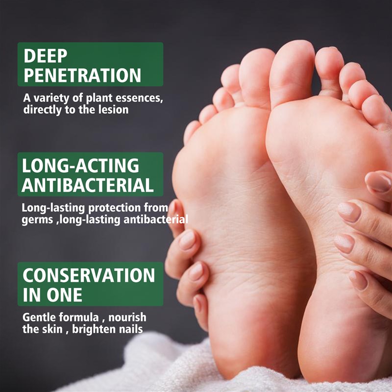 Hand Ringworm Beriberi Fungus Spray atment Infection Itch Pe