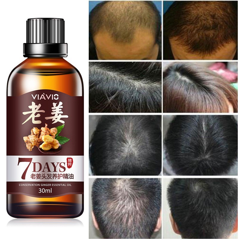 Hair Loss Treatment Ginger Growth Essence Oil老姜头发养护油