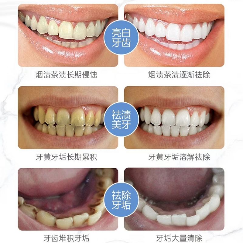 去黄亮白去牙渍去烟渍牙结石不伤牙清新炫亮洁牙粉