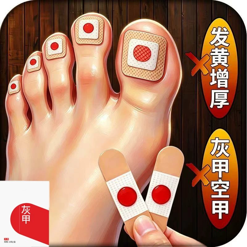 【官方正品】指甲贴正品专用灰趾贴植物萃取脚趾手指甲修护专用贴