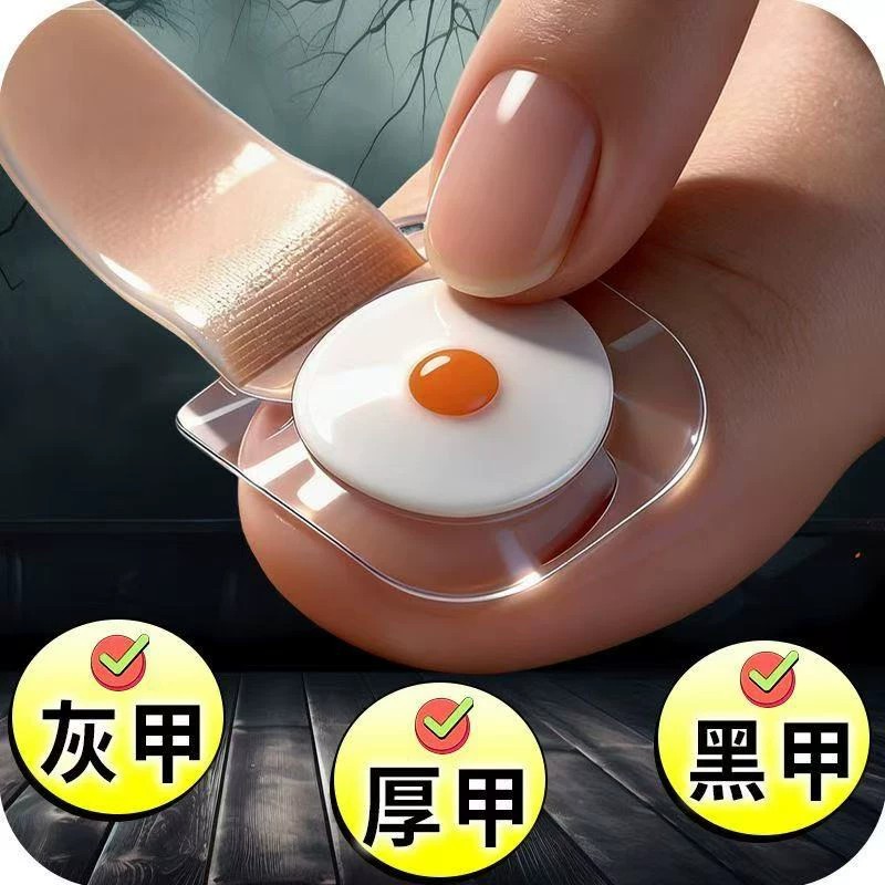 【官方正品】指甲贴正品专用灰趾贴植物萃取脚趾手指甲修护专用贴