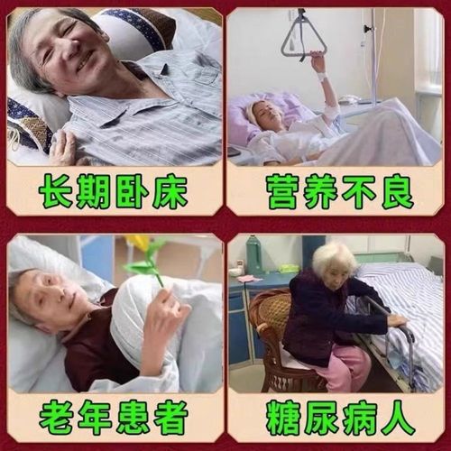速发空洞型】褥疮膏生肌膏重度压疮糖尿足老人去腐老烂腿