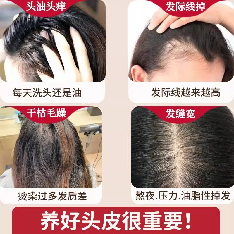 速发纯手工侧柏叶首乌植物无硅养发去屑止痒控油草本