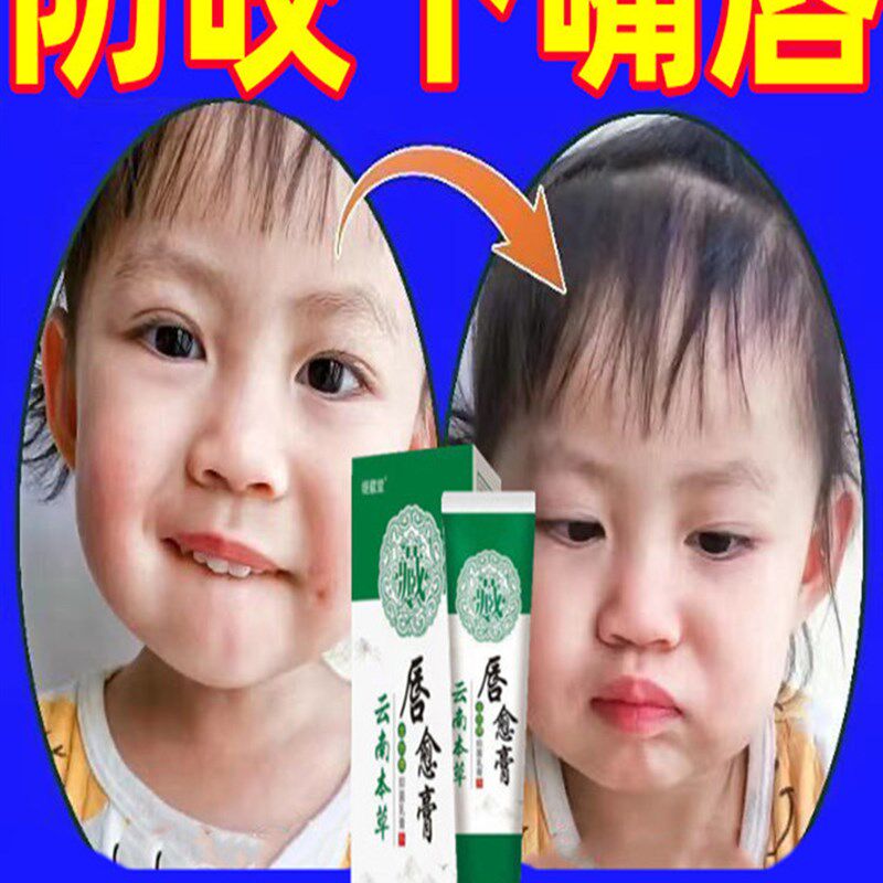 极速儿童戒咬嘴唇矫正宝宝防咬下嘴唇肌神器纠正小孩子咬嘴前庭盾