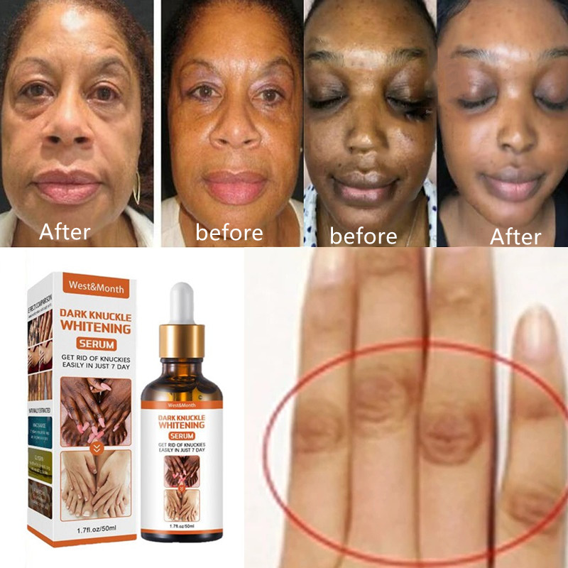 Efficient Whitening Armpit Knuckle Knee Black skin oil精华液