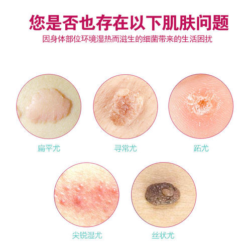 HPV阳性【最多两天】加速转阴隔离病毒抗hpv感染高低危转阴妇科凝