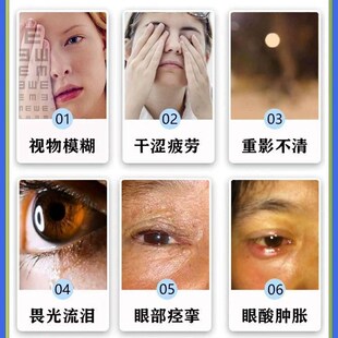 视神经修复专用神器模糊看不清缓解疲劳眼水叶黄素改善视力萎缩