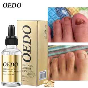 OHealthy Nail Care Fungus Nail Repair Essential Oil Hand and
