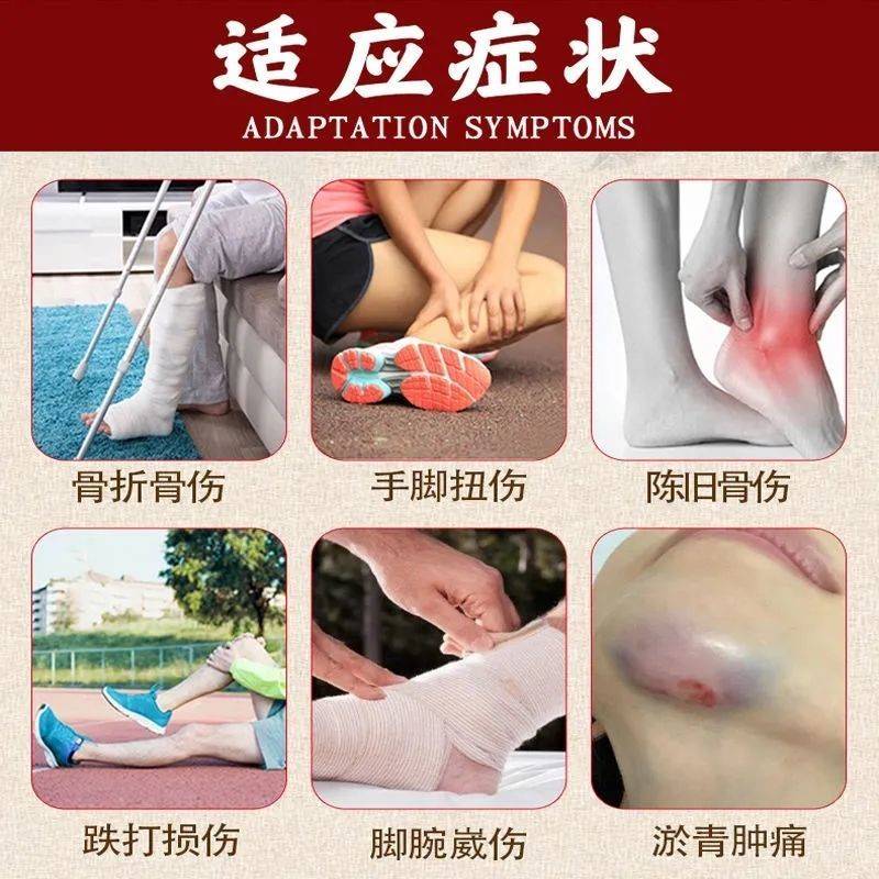 速发跌打损伤喷雾剂骨折扭伤止痛手腕脚踝崴脚筋骨疼痛肌肉拉伤外
