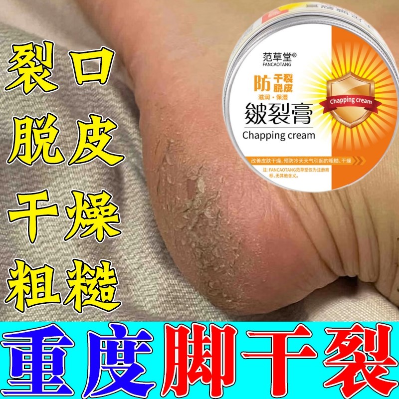 现货速发专治严重干裂脚后跟开裂足裂手足干裂皴裂膏干燥龟皲裂护