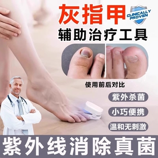 灰指甲治疗仪紫外线激光杀菌光疗机清洁灯便携式护理辅助工具