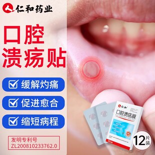 口腔溃疡贴膜口疮溃疡专用贴嘴巴上火舌头起泡烂儿童创可贴片喷剂