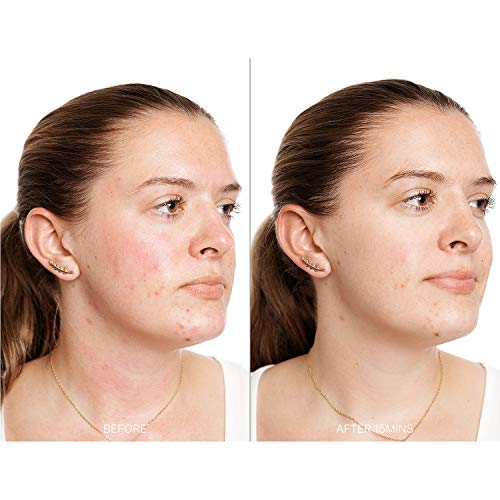 KORRES Greek Yoghurt Probiotic Superdose Face Mask