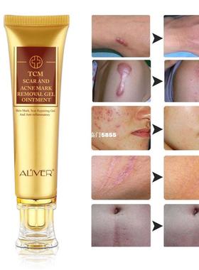 ALIVER Ginseng Acne Scar Removal Face Gel Stretch Cut Burn S