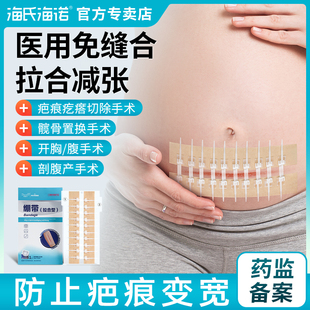 海氏海诺减张器减张贴医用剖腹产术后皮肤疤痕儿童免缝合伤口贴