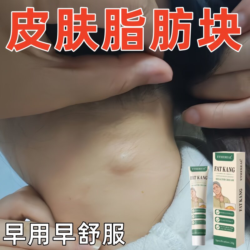 正品脂肪康肿块膏瘤膏皮下凸块身上鼓包涂抹膏