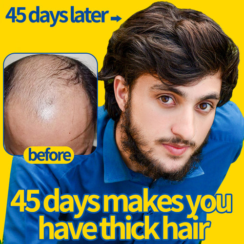 Hair Growth Serum Prevent Hair Loss Treatment Thinning Hair