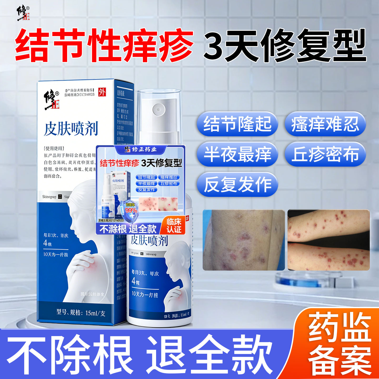 一喷不痒医用皮肤喷剂滁湿疹