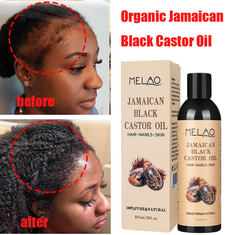 Jamaican Organic Black Castor Oil Hair Growth Scalp黑蓖麻油