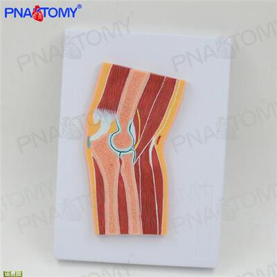 极速人体MRI肘关节骨骼肌肉剖面构造解剖模型M医学骨科疼痛科教学