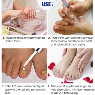 Nail Fungus Treatments iBeaLee Foot Grey Essence Care Repair