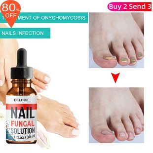Anti Fungal Removal Finger Gel Nail Liquid Serum Foot Repair