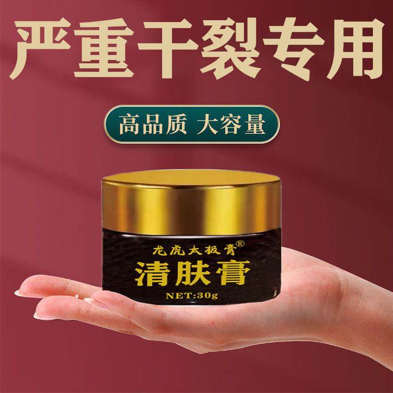 新品【老偏方】鹅掌风干裂脱皮瘙痒止痒特效膏手脚真菌感染