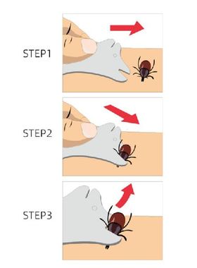 Pet Tick Detaching Device Dog Flea Removal Kit Highly
