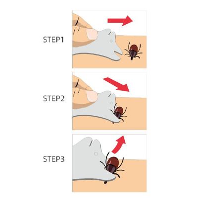Pet Tick Detaching Device Dog Flea Removal Kit Highly