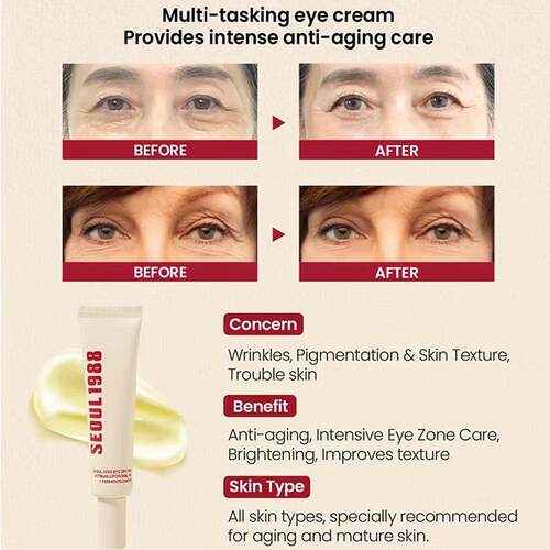 跨境爆款Seoul 1988 Eye Cream视网膜眼霜脂质体4%紧致眼霜温和