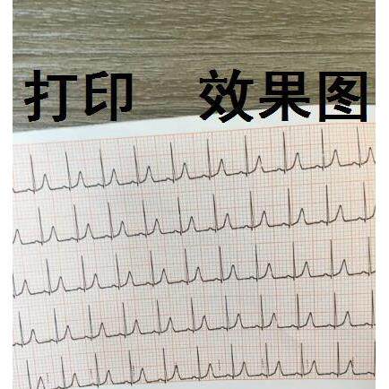 理邦SE-3科曼CM300 中旗1203迈瑞宝莱特心电图记录打印纸80mm*20m