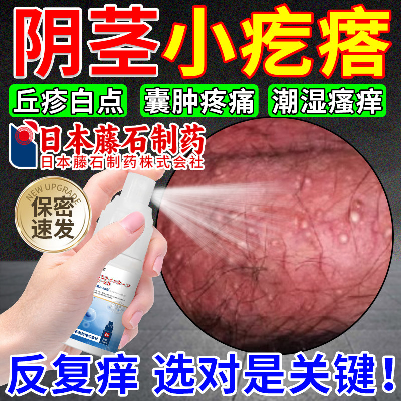 皮脂腺异位症阴茎阴囊小疙瘩白色脂肪颗粒潮湿瘙痒珍珠样丘疹om