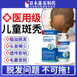 藤石制药儿童脂溢性斑秃生发液特鬼剃头效遮盖神专器用膏洗发水OM