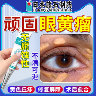 去眼睑黄色瘤黄瘤睑黄疣眼角黄斑瘤祛脂肪粒除眼部眼角斑汗管瘤OM