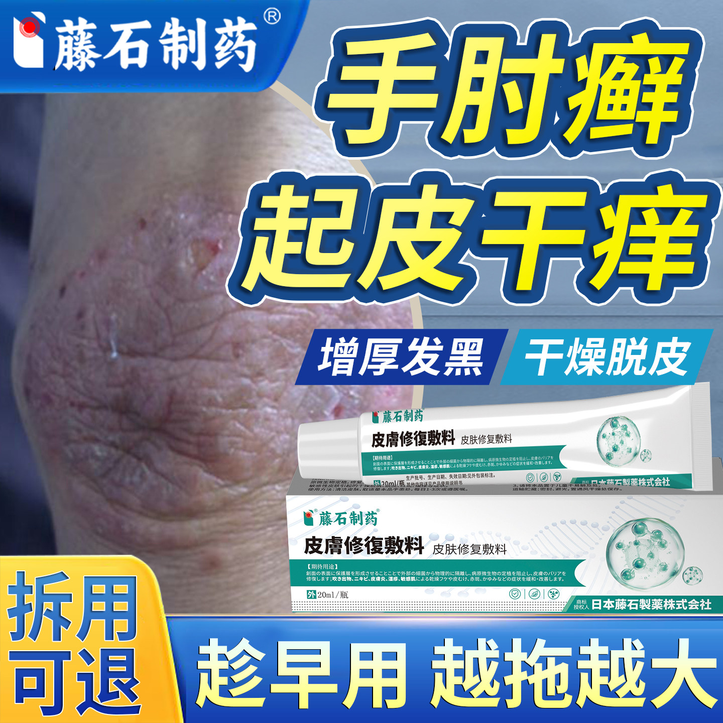 手肘癣干燥起皮开裂皮炎膏去胳膊肘除黑死皮神器黑色素沉淀药房OM