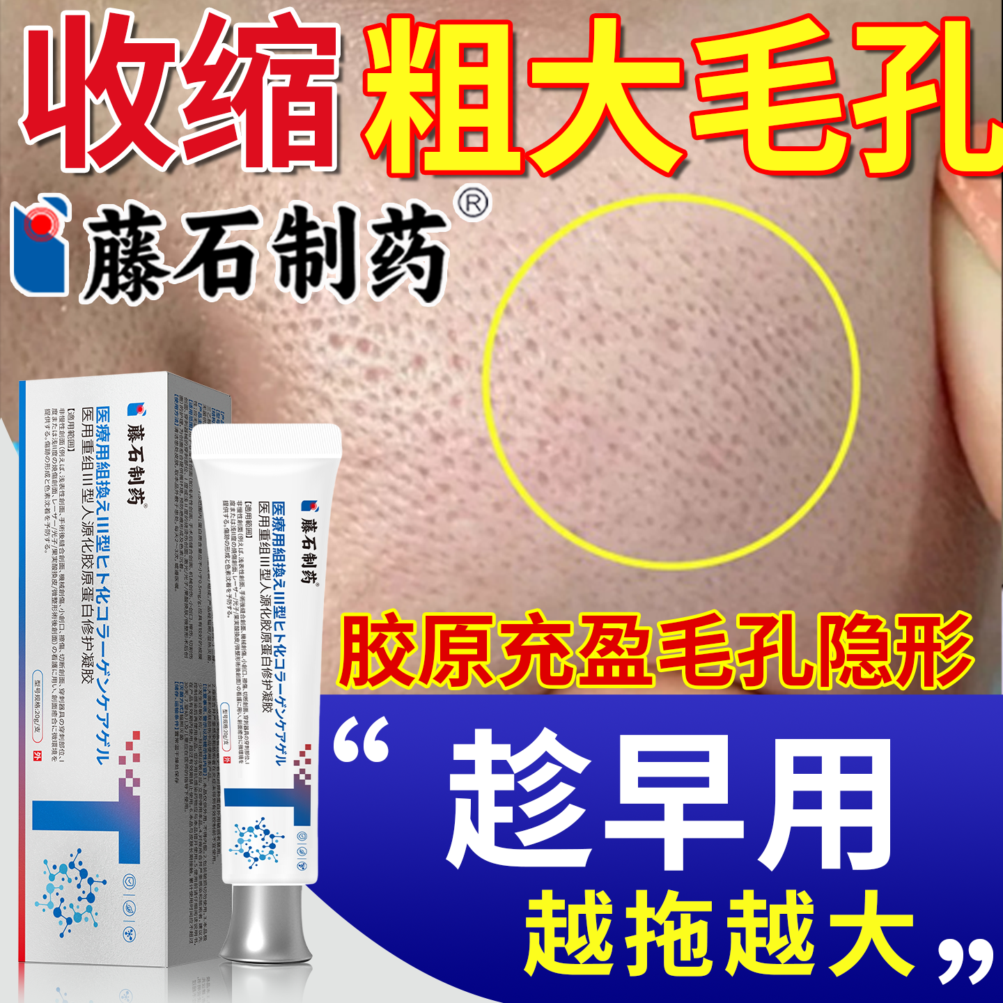 脸颊毛孔粗大重组三型人源化胶原蛋白修护凝聚面部活细胞填充OM