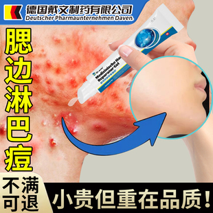 淋巴腮边痘下巴反复脸上长痘痤疮脖子脸颊两边下颚脓包痘印闭口OM