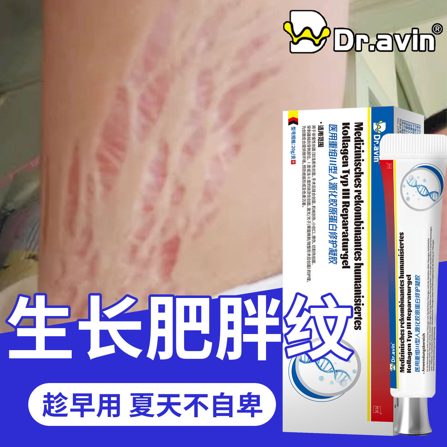青少年专用生长纹修复膏去肥胖纹修复霜消除大腿去淡化药房同售OM