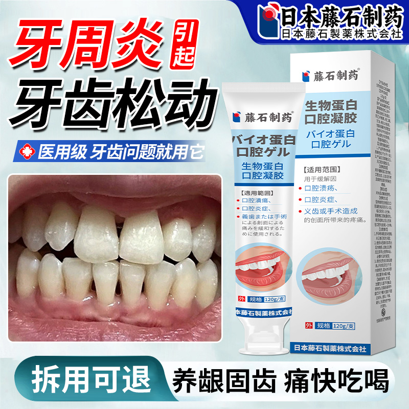 牙齿松动牙龈萎缩专用固齿慢性牙龈出血牙周炎敏感酸软可搭牙膏EH