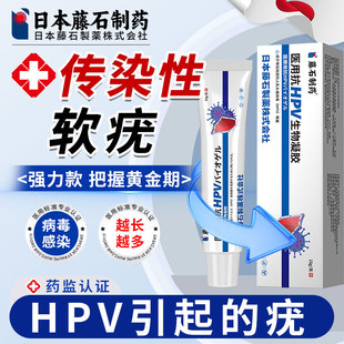 传染性软疣病毒性水瘊子疣瘊肉粒一抹无忧可搭配医用镊子FT