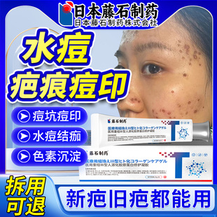 去水痘坑痘印疤痕生长因子凹陷疤痕膏黑色素沉淀儿童修复成淡化OM