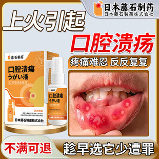 反复口腔溃疡上火复发性溃疡口角溃烂表皮破损官方正品旗舰店FT