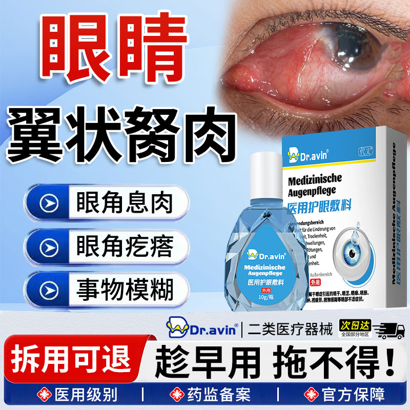 去眼睛胬肉眼角长翼状胬肉眼模糊除有异物感可搭配滴眼液眼药水OM