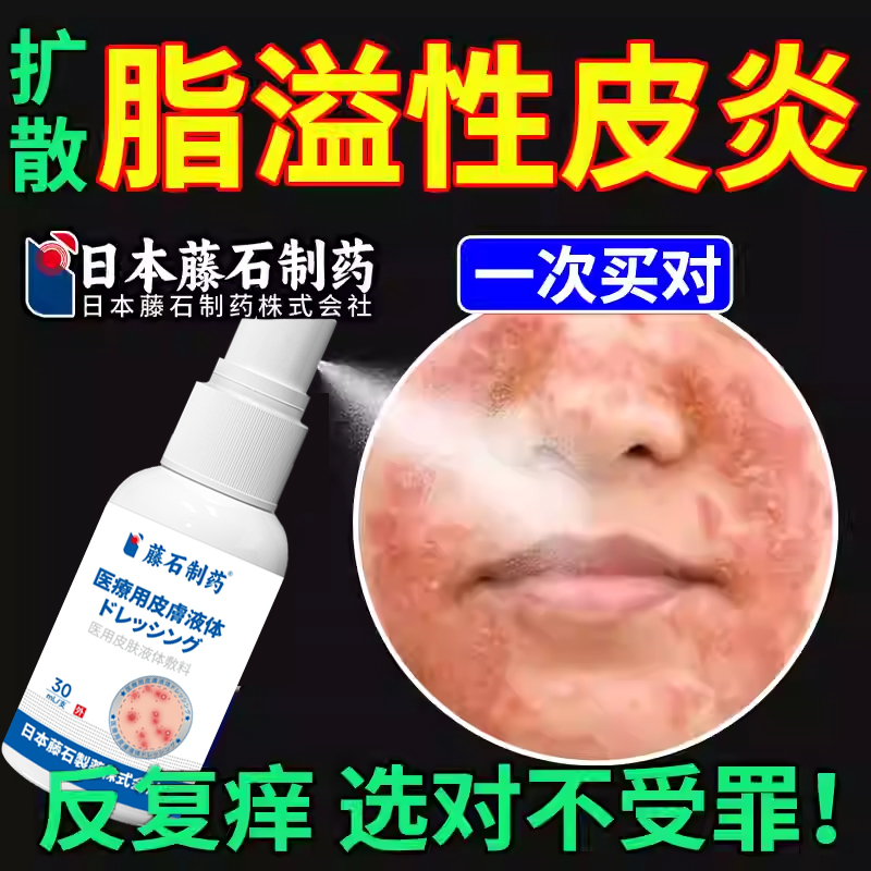 日本监制脂溢性皮炎喷剂