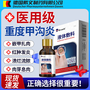 甲沟炎嵌甲特息肉去消肿消炎化脓效去肉芽指甲液软化剂药水EH